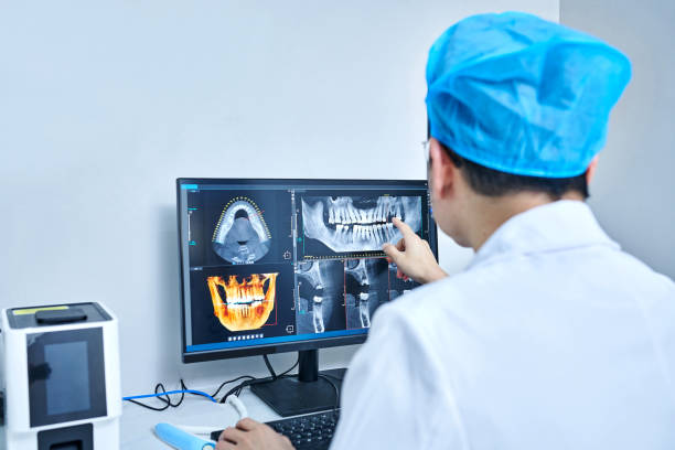 Best Emergency Wisdom Tooth Extraction in New Berlin, WI